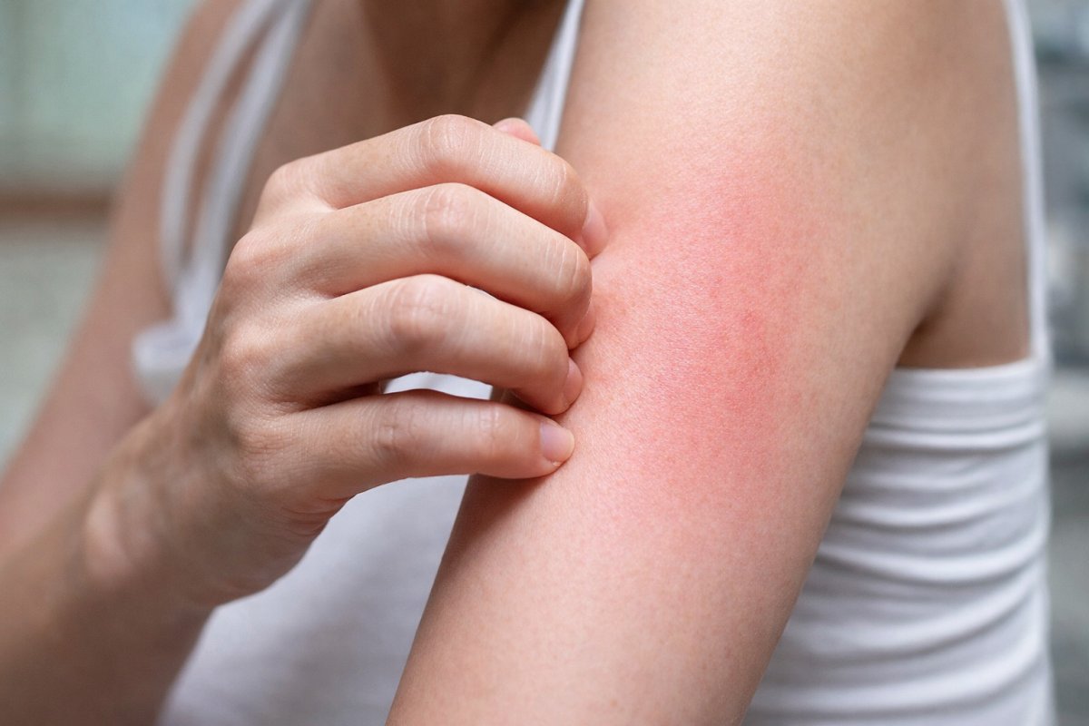 Що означає свербіж у різних частинах руки Що означає свербіж у різних частинах руки